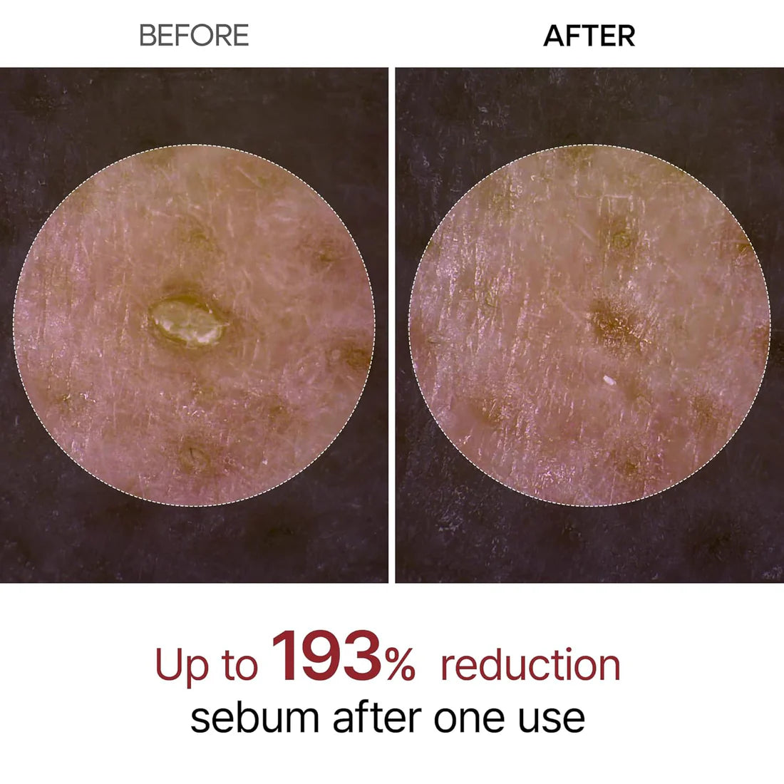 ✨ Peeluxy Radiant Glow Exfoliating Serum
