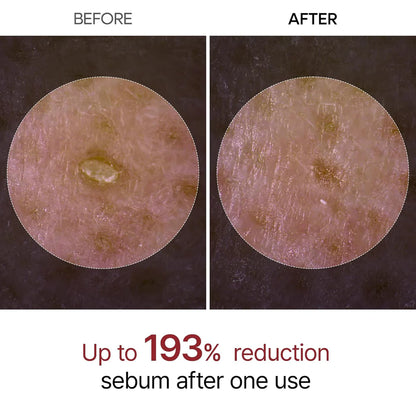 ✨ Peeluxy Radiant Glow Exfoliating Serum